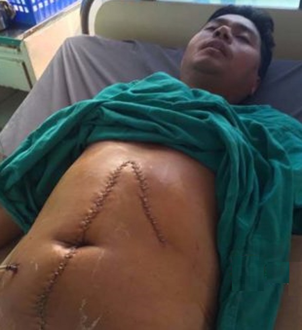 सामान्य भनाभनमा प्रहरीको कुटाइबाट बस्नेत गम्भीर घाइते