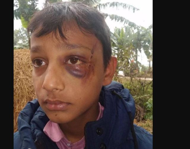 होमवर्क नगरेको भन्दै बिद्यार्थी कुट्ने शिक्षक बराई पक्राउ