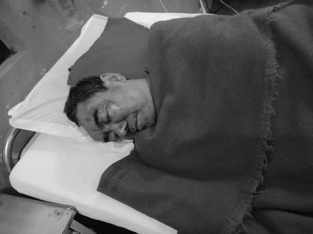 होटल ब्यबसायी गुरुङमाथी सांघातिक आक्रमण : लोक गायक प्रकाश कटुवाल शंकाको घेरामा !