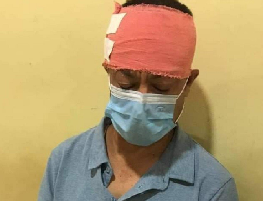राससका बरिष्ठ समाचारदाता कार्कीमाथि आक्रमण, आक्रमणको चौतर्फी बिरोध