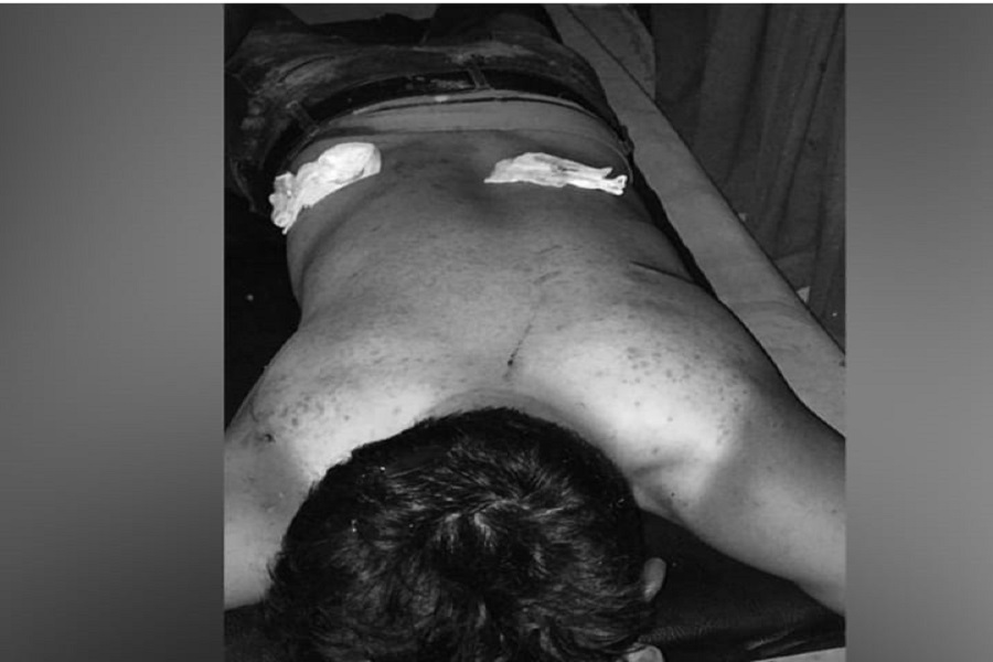 स्याङ्जाको चापाकोटमा एमाले र काँग्रेस कार्यकर्ता बीच खुकुरी हानाहान