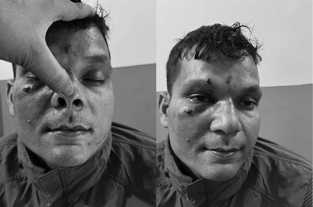 भाइटिकाको राती कन्चनपुरमा प्रहरीले दादागिरी देखाए पछि स्थानीय बासिन्दाले गरे प्रतिरोध (हेर्नुस भिडियो)