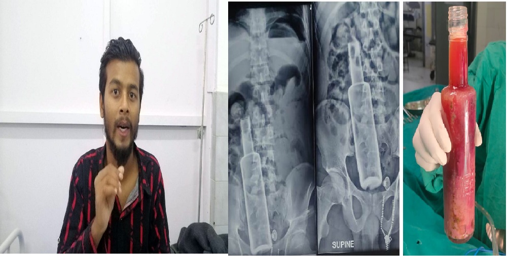 साथीहरुले मलद्वारबाट रक्सीको बोतल छिरादिएर गम्भीर घाइते मन्सुर निको भइ अस्पतालबाट भए डिस्चार्ज