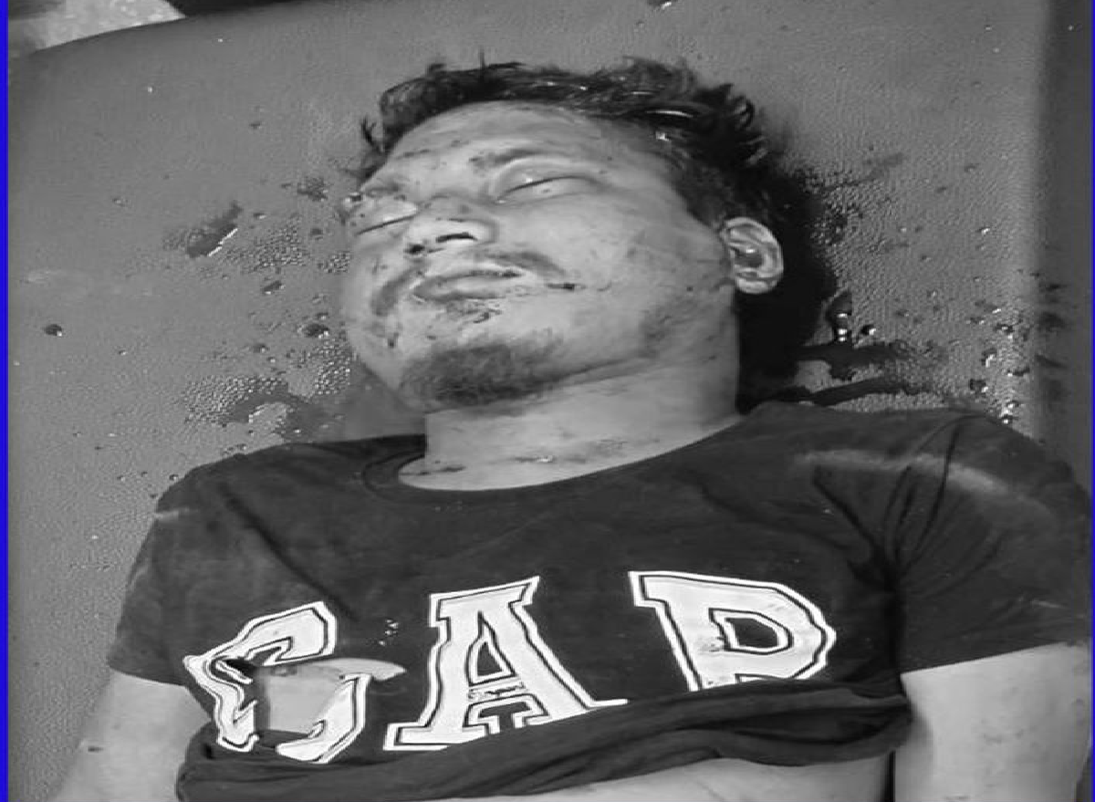 जिपको ठक्करबाट मृत्यु भै हाल बेवारिशे शव