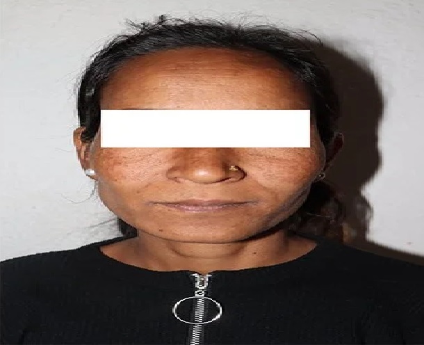 अछाममा छिमेकीको हत्या गरेर भागेकी महिला काठमाडौँमा पक्राउ