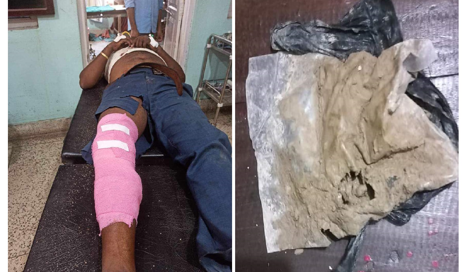 प्रहरीले गोली हानेर पक्राउ गरेको भनिएका लागू औषध कारोबारी भागीरथी हरिजन