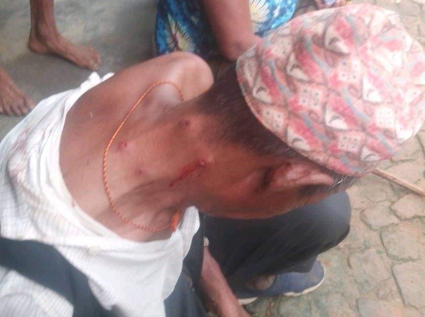 बाघको आक्रमणबाट घाइते