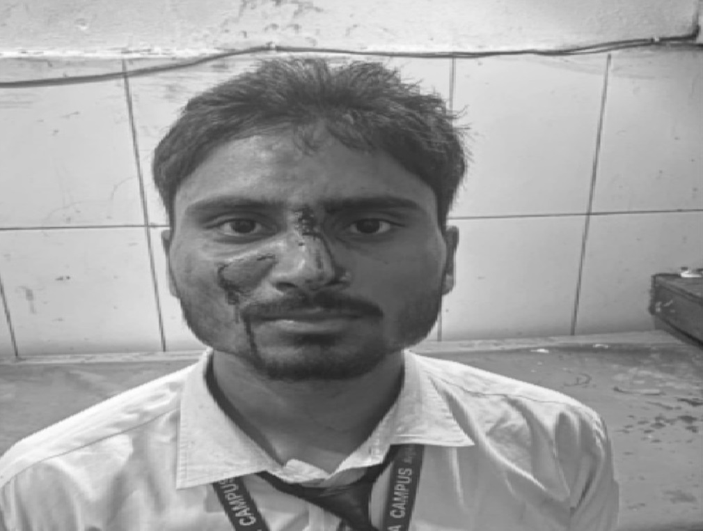 घाइते नेविसंघ दाङका नेता शिवम मिश्रा