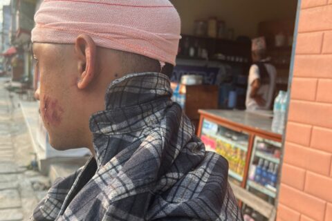 पोखराका युवामाथि तनहुँको मानुङकोटमा सांघातिक आक्रमण : दुई जना घाइते, पांच जना पक्राउ