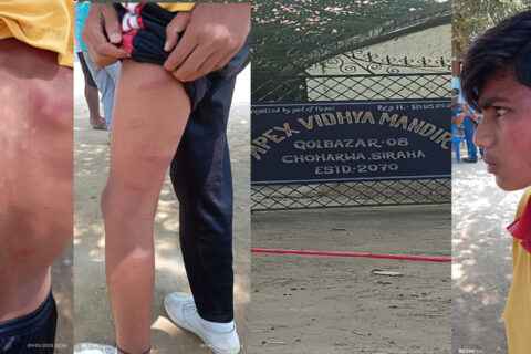 गृहकार्य नगरेको भन्दै सिरहामा शिक्षकले विद्यार्थीलाई मुर्छित हुने गरी बाँसको लठ्ठीले कुटे