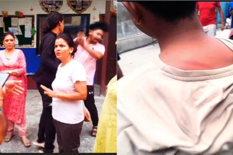 कक्षा काेठामा मकै खाएकाे भन्दै तनहुँमा शिक्षकले तीन जना बिद्यार्थीलाई पाइपले  कुटे